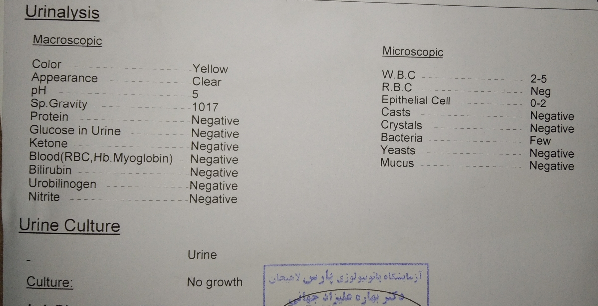 خواندن جواب ازمایش ادرار