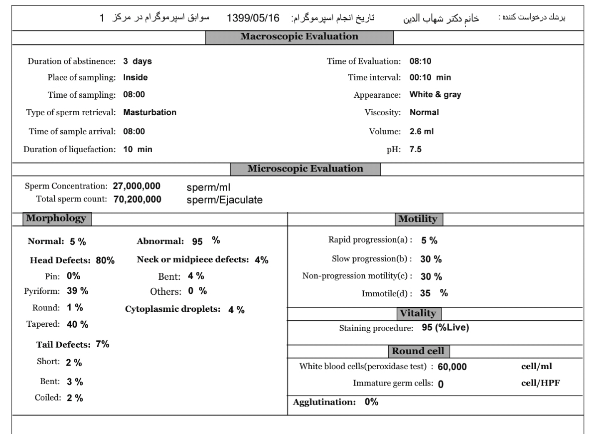 تفسیر آزمایش اسپرم همسرم