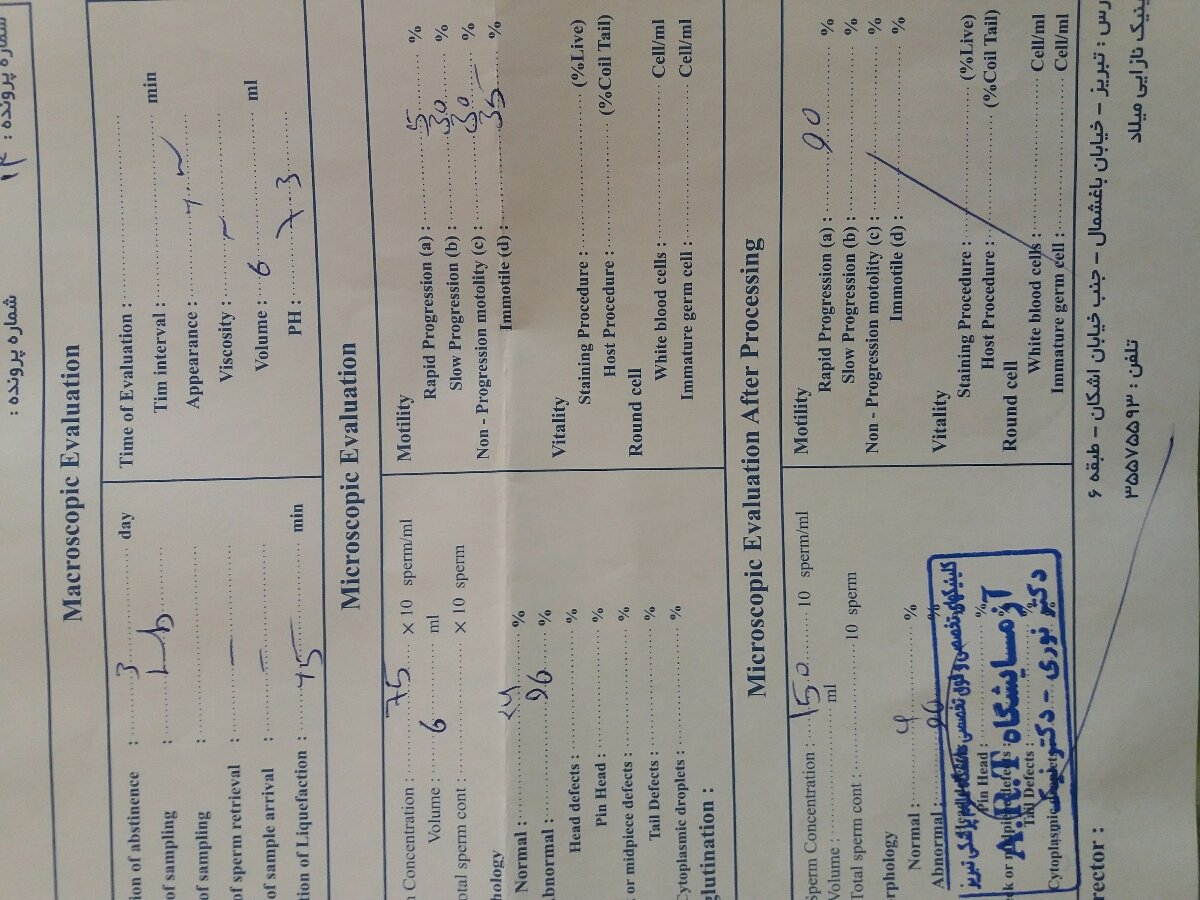 تفسیر آزمایش همسرم؟؟؟
