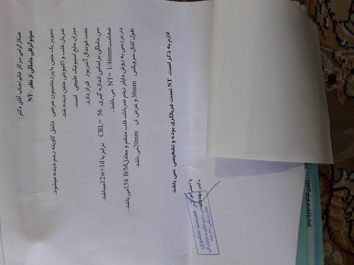 تفسیر سونو ان تی