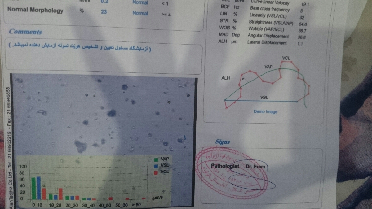 تفسیر تست پاپ اسمیر و اسپرم