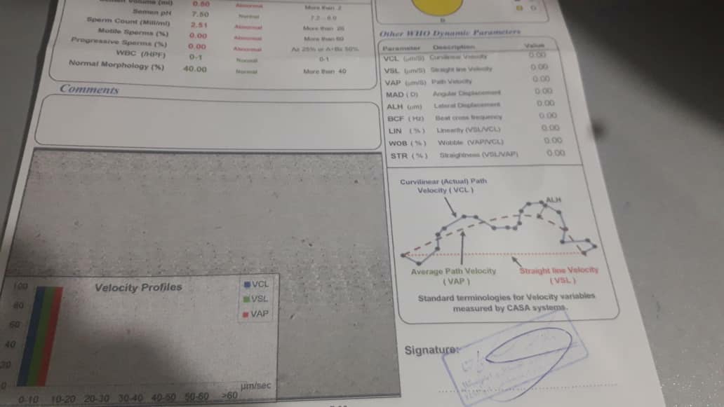 آزمایش اسپرم شوهرم را تفسیرکنید