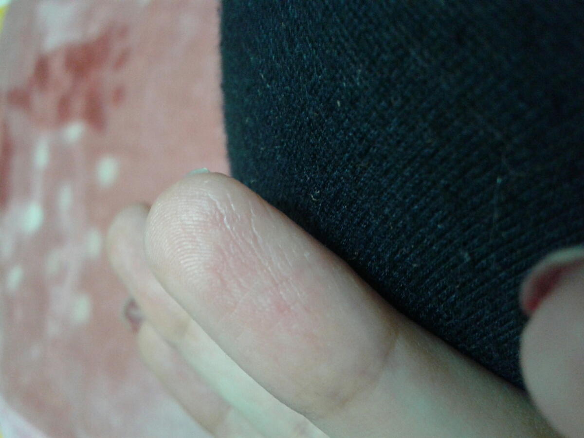 تاحالا کسی انگشتش ایجور شده مث من؟