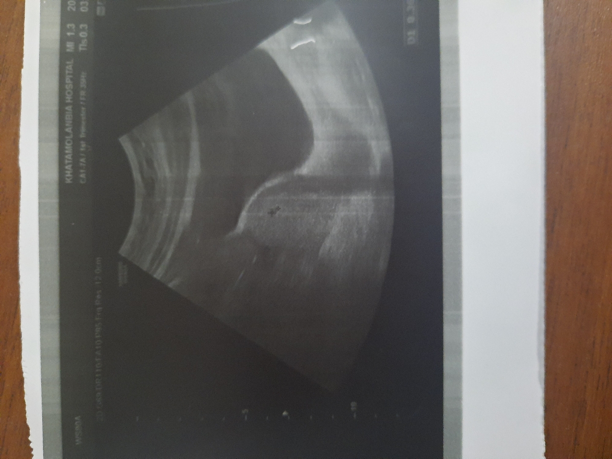 سونوی منو تفسیر کنید لطفا