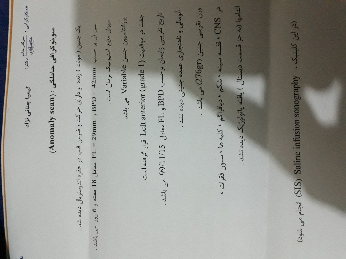 تفسیرسنو آنومالی دخملم مرسی😊😊