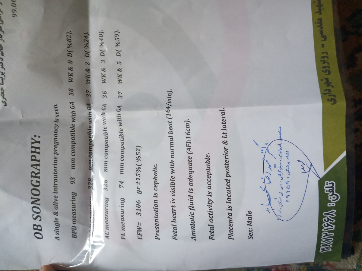 تفسیرسنوگرافی هشت ماهگی وتاریخ زایمان