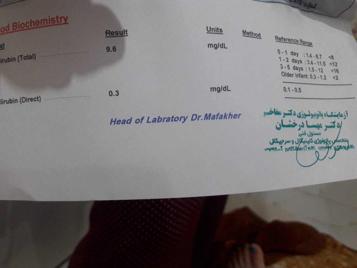 زردی نوزاد من به چه شکلیه بر اساس آزمایش اقدام بعدی چیه