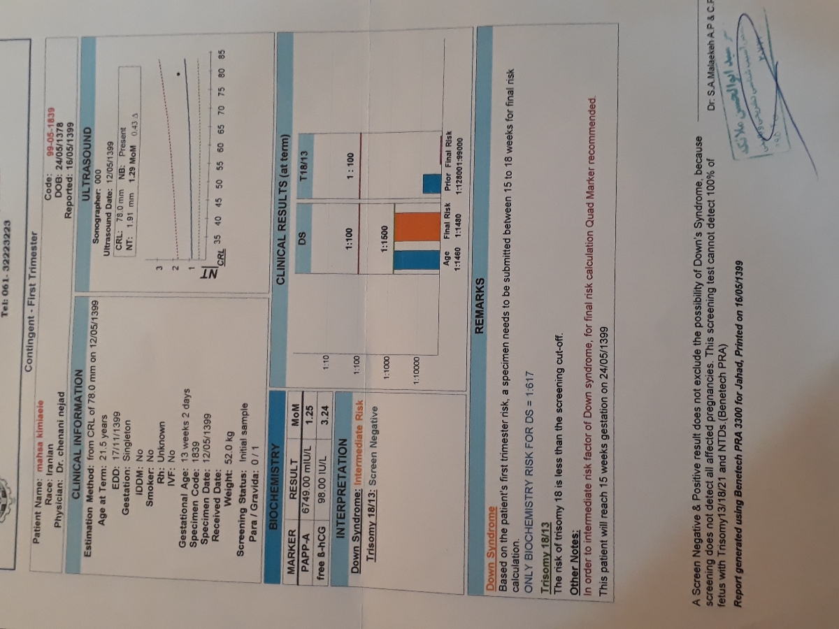 تفسیرسنو آنومالی دخملم مرسی😊😊