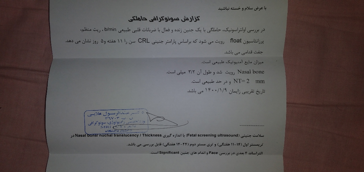 سونو غربالگری اول ان تی