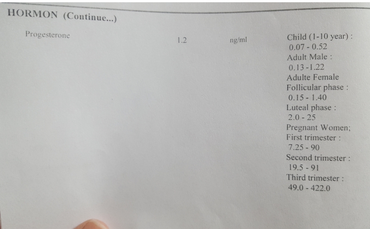 خانمایی ک تنبلی تخمدان داشتن و بدون استفاده از دارو محرک تخمدان باردار شدن بصورت طبیعی میان ب من امید بدن؟😔 خانمایی ک تنبلی تخمدان داشتن و بدون استفاده از دارو محرک تخمدان باردار شدن بصورت طبیعی میان ب من امید بدن؟😔