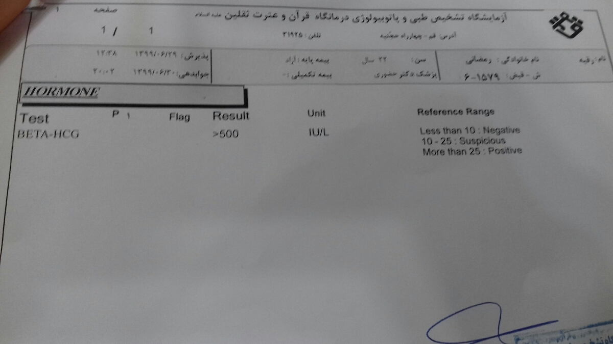 میزان بتا چجوری بالا میرود؟؟