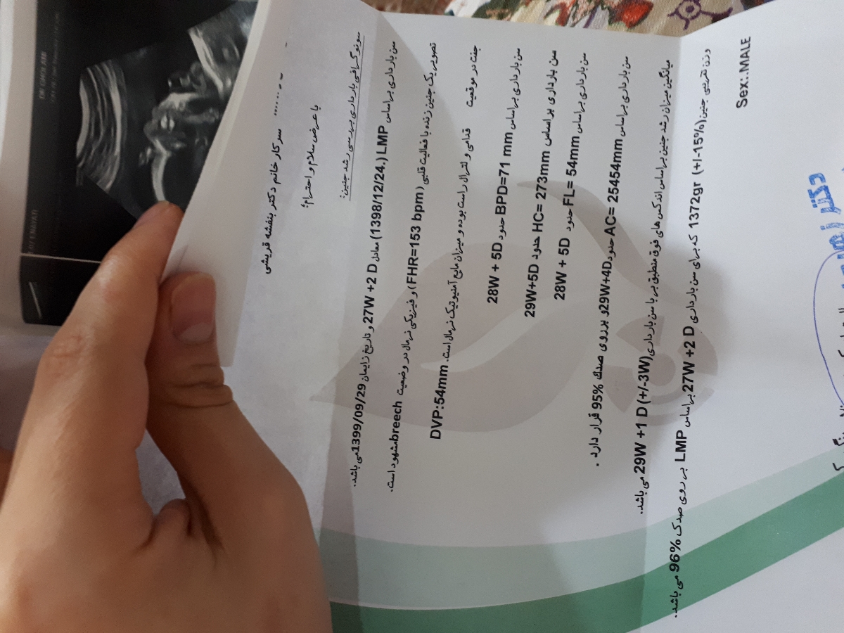 سونوی ۲۸ هفته