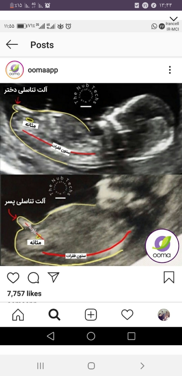 سلام دوستان بیاین یه سوال دارم