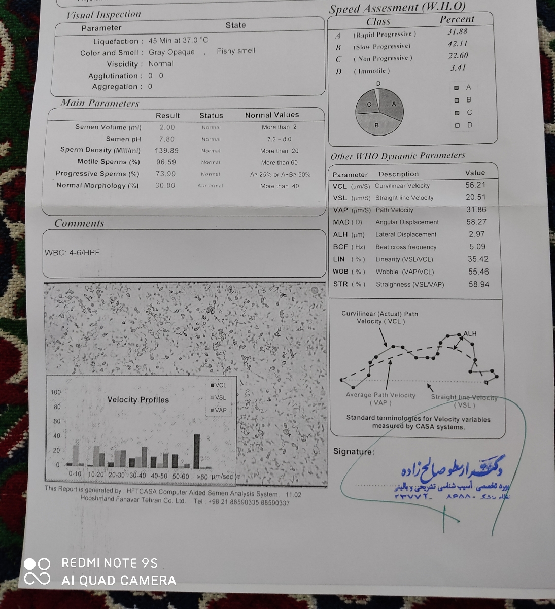 تفسیر ازمایش اسپرم همسرم تفسیر ازمایش اسپرم همسرم