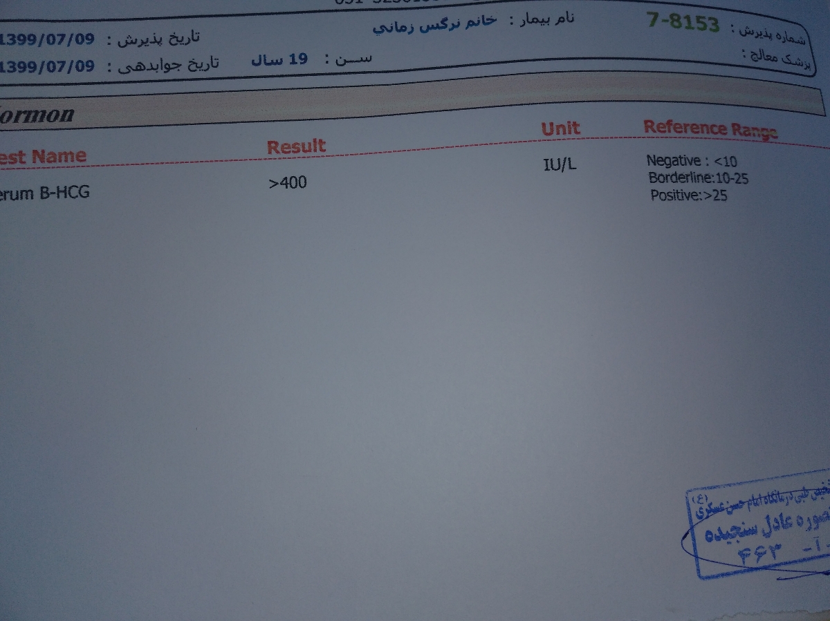 بی بی چک مثبته یامن خیالاتی شدم بی بی چک مثبته یامن خیالاتی شدم
