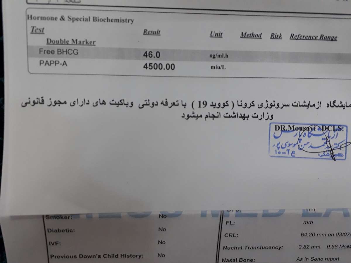 دکتر جان آزمایش ان تی منو تفسیر میکنین.