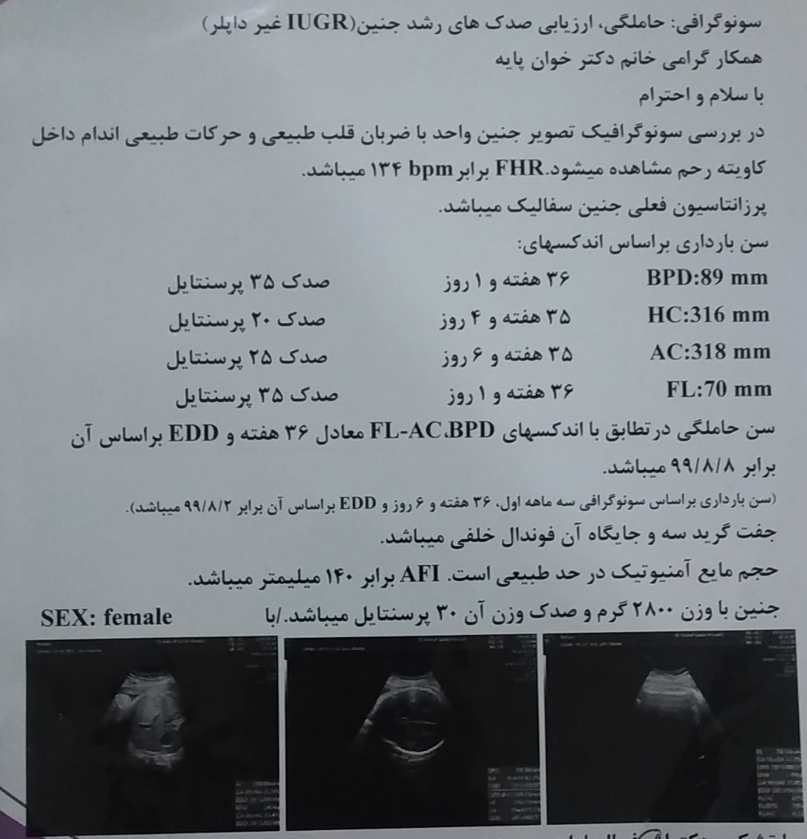 🤰🤰سونو گرافی هفته ۳۶ بارداری🤰🤰