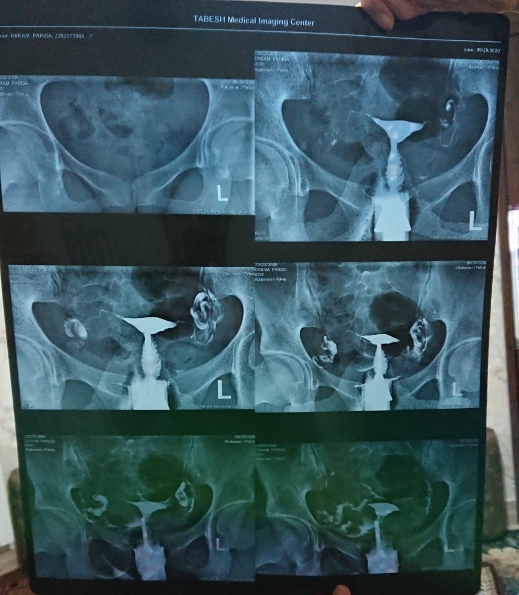 جواب عکس رنگی رحم