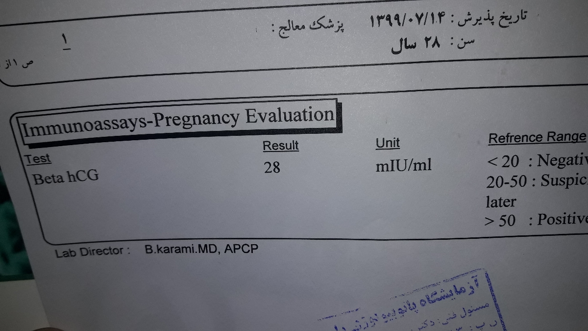 بیبی زدم از دیروز تو فکرم