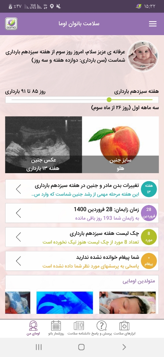 جواب سونو ان تی