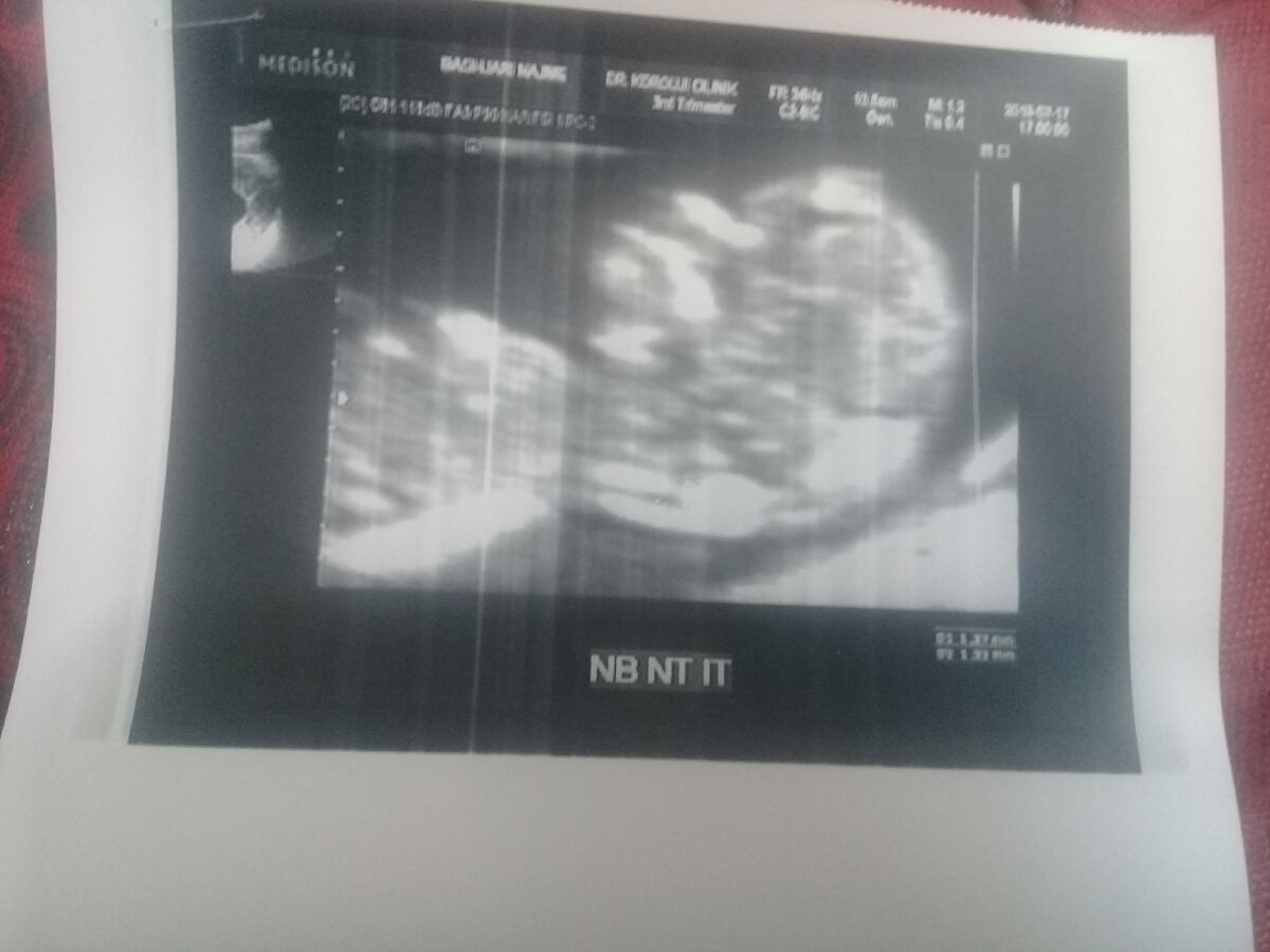 سلام دکتر اوما و دوستانی که سردرمیارن از سونو عکس سونومومیفرستم ببینیدهمه چی خوبه یا نه؟