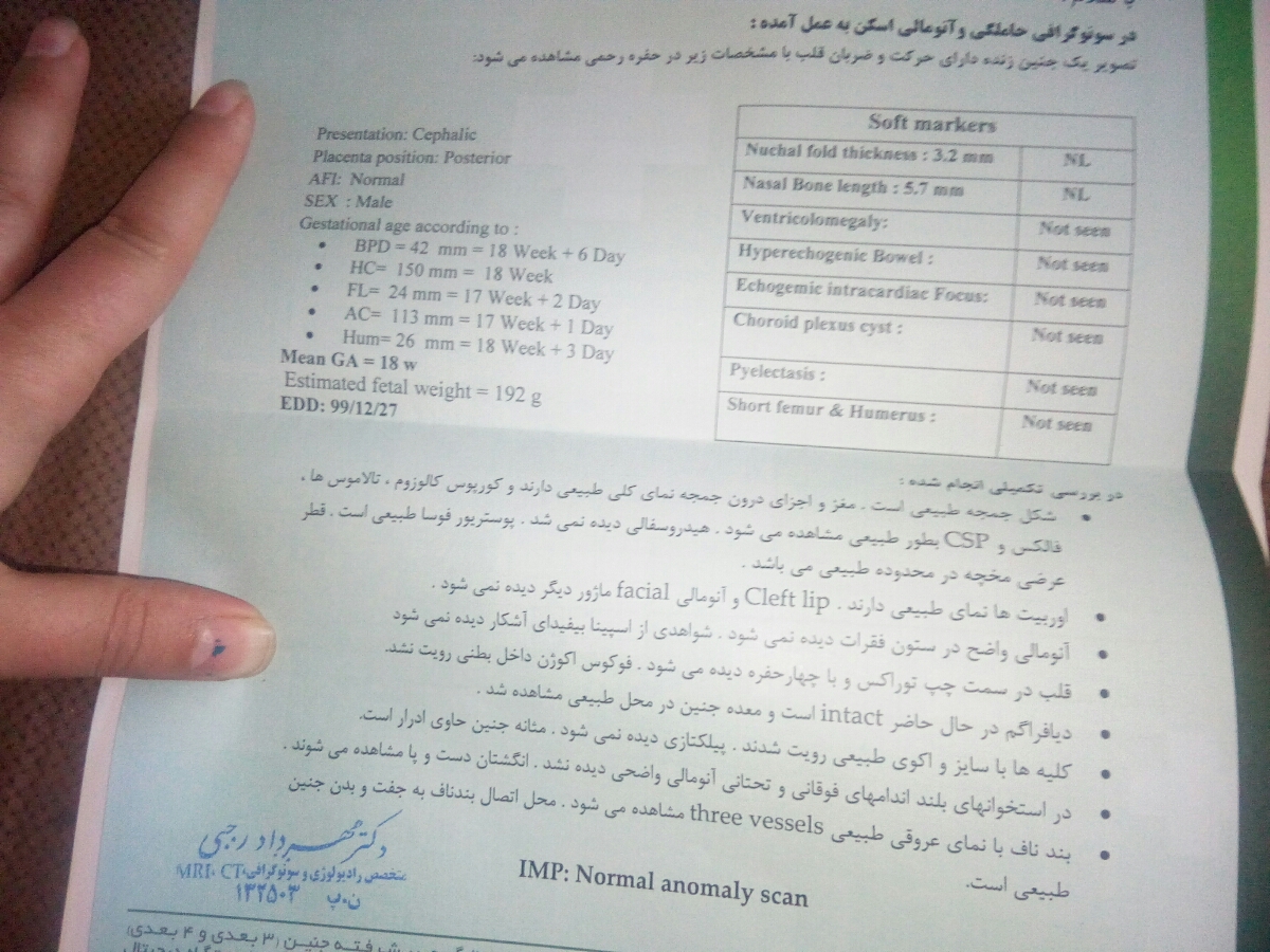 تفسیر سونوگرافی انومالی