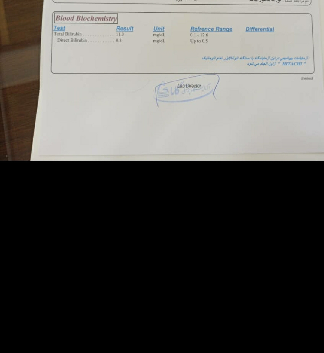 ازمایش زردی خوبه یا نه