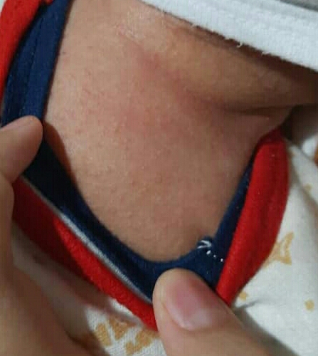 خانما کیا نی نیشون آلرژی داره خانما کیا نی نیشون آلرژی داره