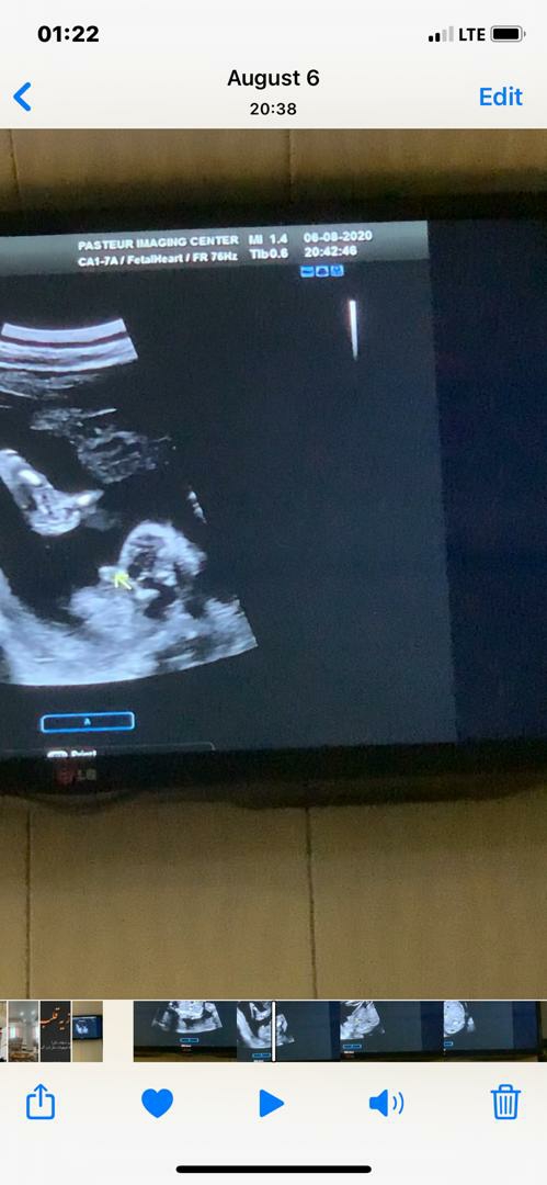 سلام دوستان مولتی ویتامین چاق کنندس؟؟