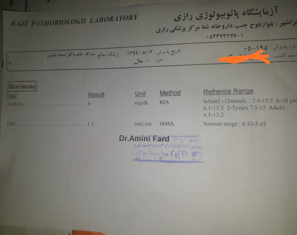تفسیر آزمایش تیروئید کم کاری تیروئید