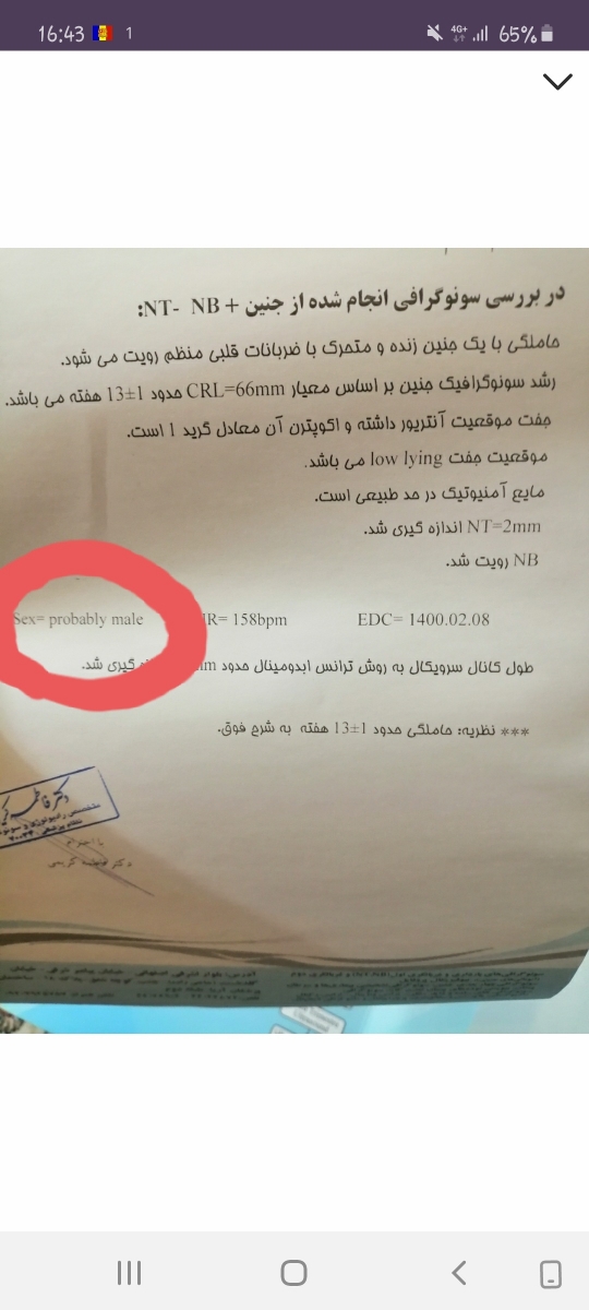 تفسیر آزمایش NT غربالگری مرحله اول