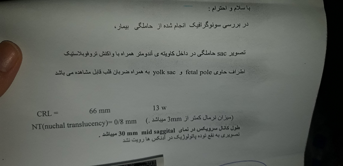 تفسیر سونو nt اول