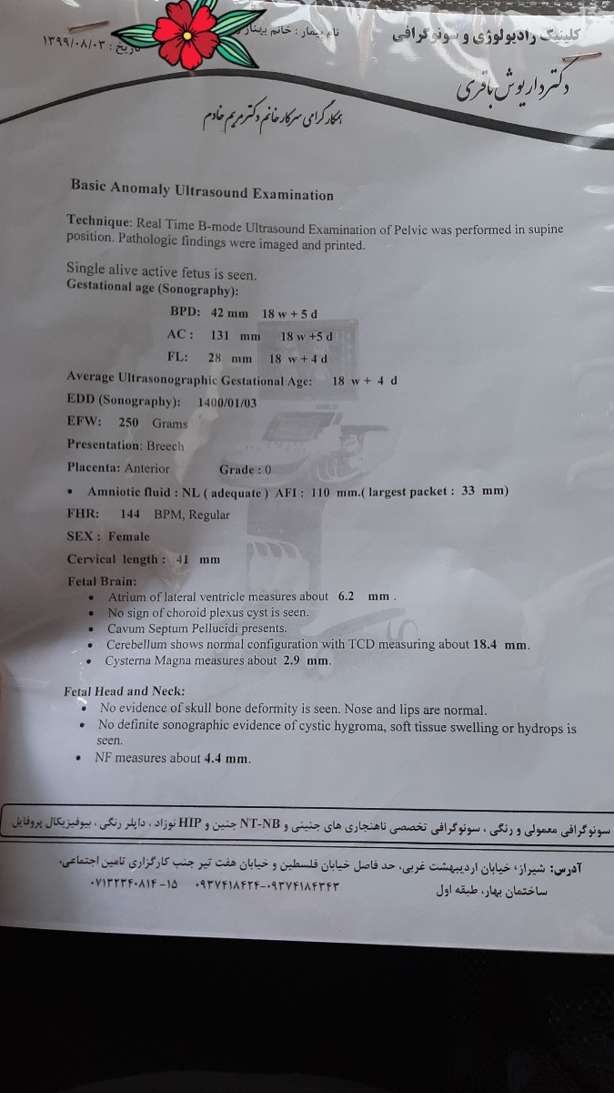 بچه ها بیاین انومالی منو ببینید