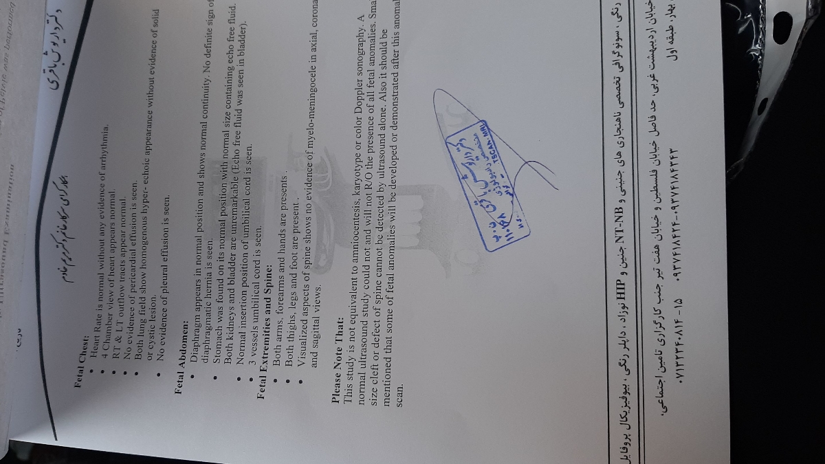 بچه ها بیاین انومالی منو ببینید