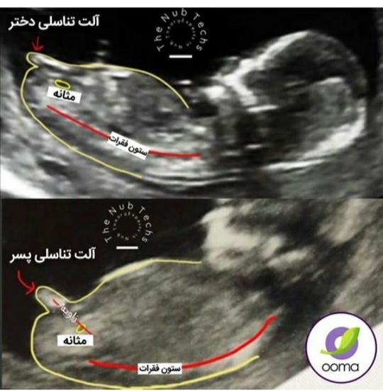 تعیین جنسیت و بگین بمن قربونتون😍 تعیین جنسیت و بگین بمن قربونتون😍