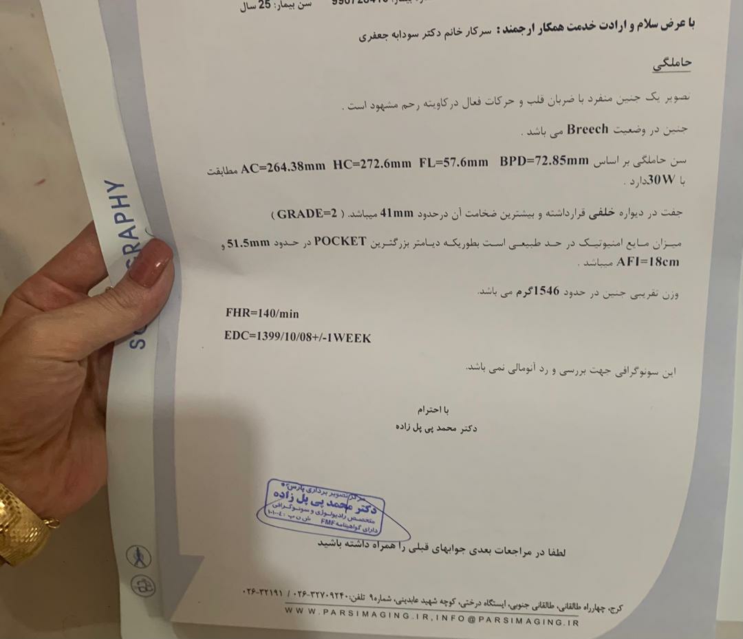 تعیین جنسیت و بگین بمن قربونتون😍 تعیین جنسیت و بگین بمن قربونتون😍