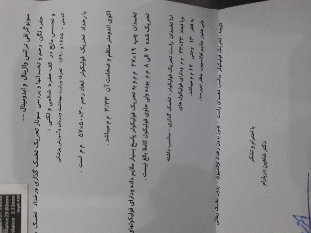 تفسیر سونوگرافی روز ۱۱ سیکلم بعد ازمصرف لتروزول تفسیر سونوگرافی روز ۱۱ سیکلم بعد ازمصرف لتروزول