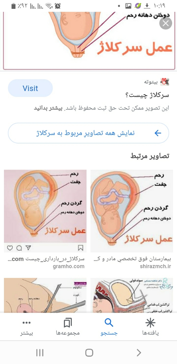 خانمایی که سرکلاژ شدن یه لحظه