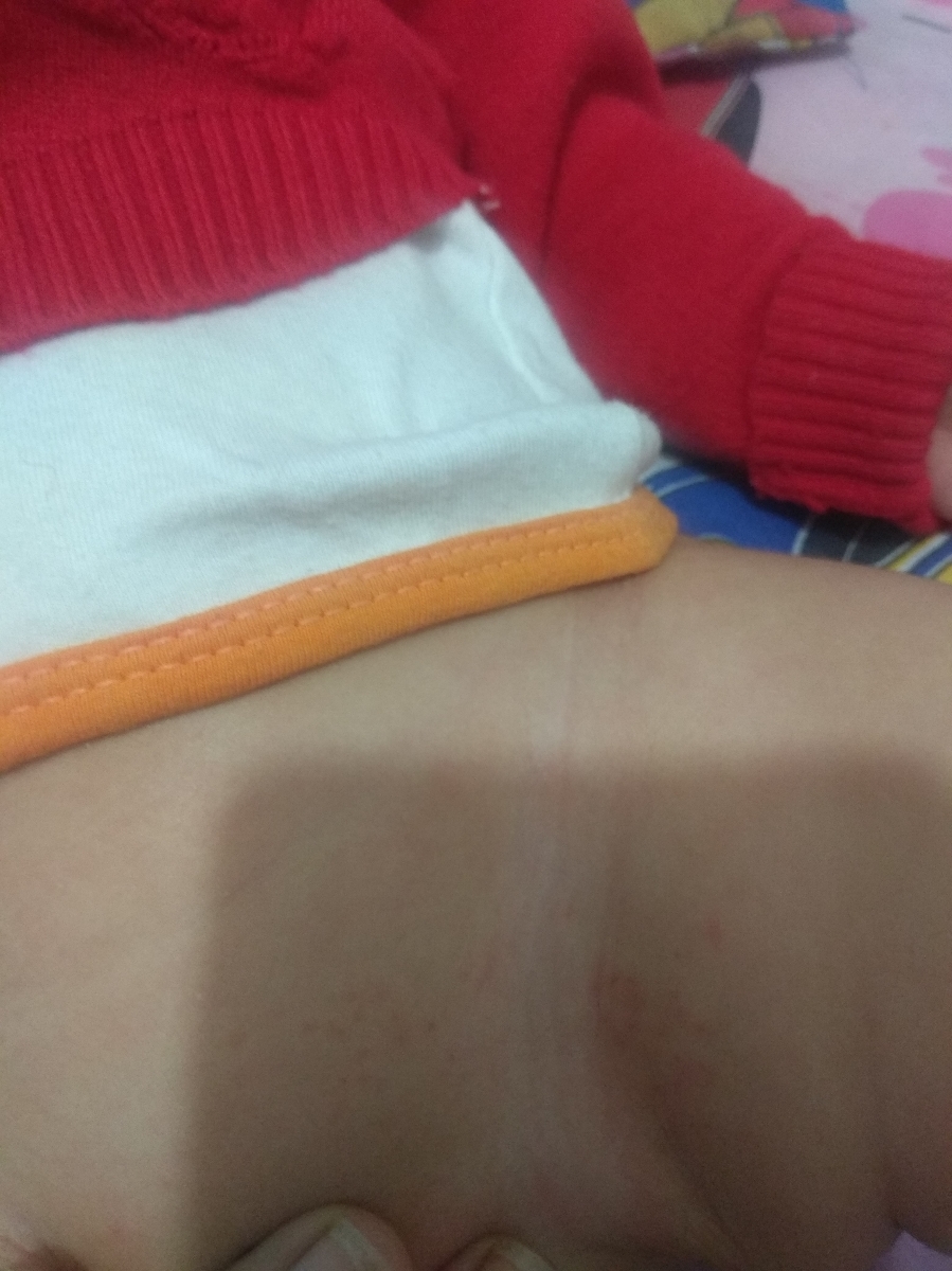 آلرژی،دانه های ریز قرمز