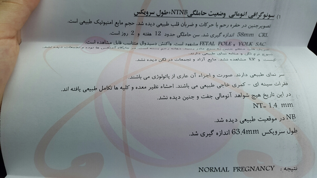بیاین ان تی منو ببینین. متخصصین تعیین جنسیت بیاید