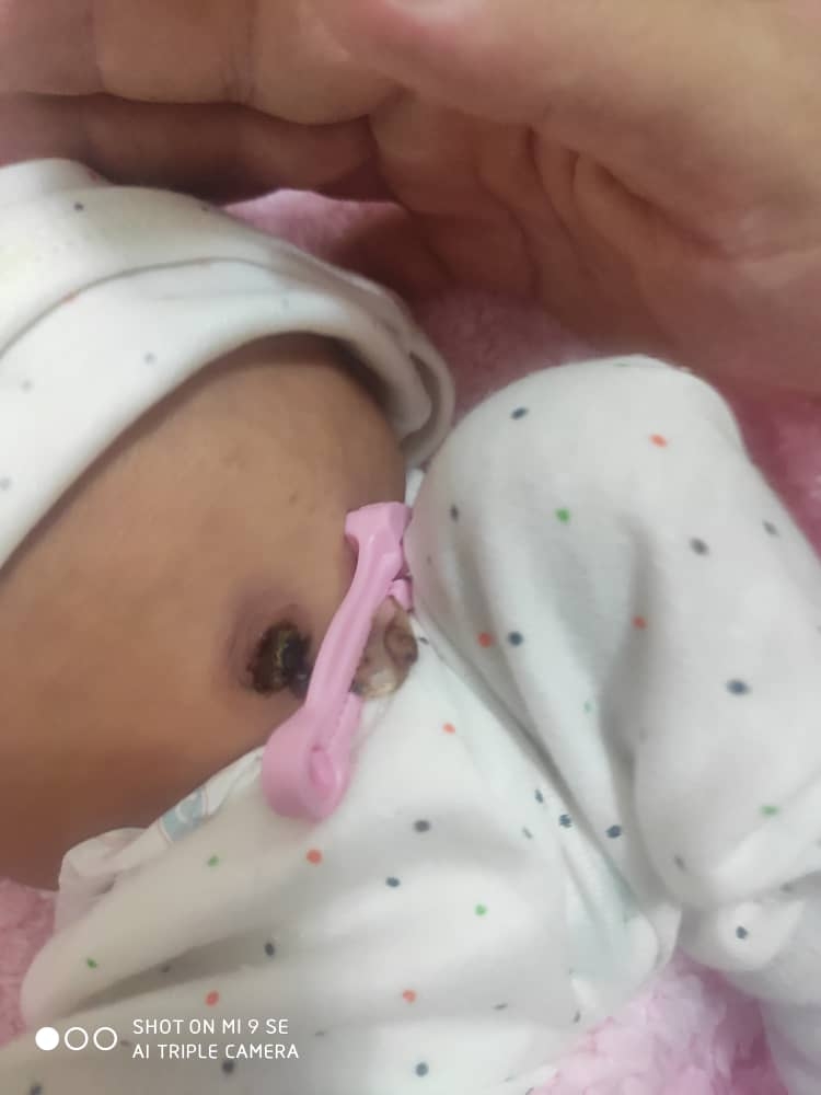 بچه ها بیایید ناف دخترم رو ببنید نگرانم.