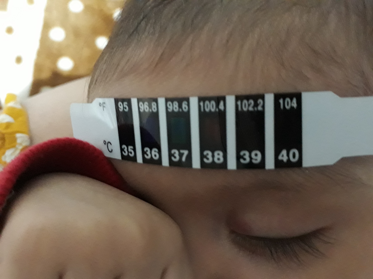 واکسن دوماهگی دخترموزدم