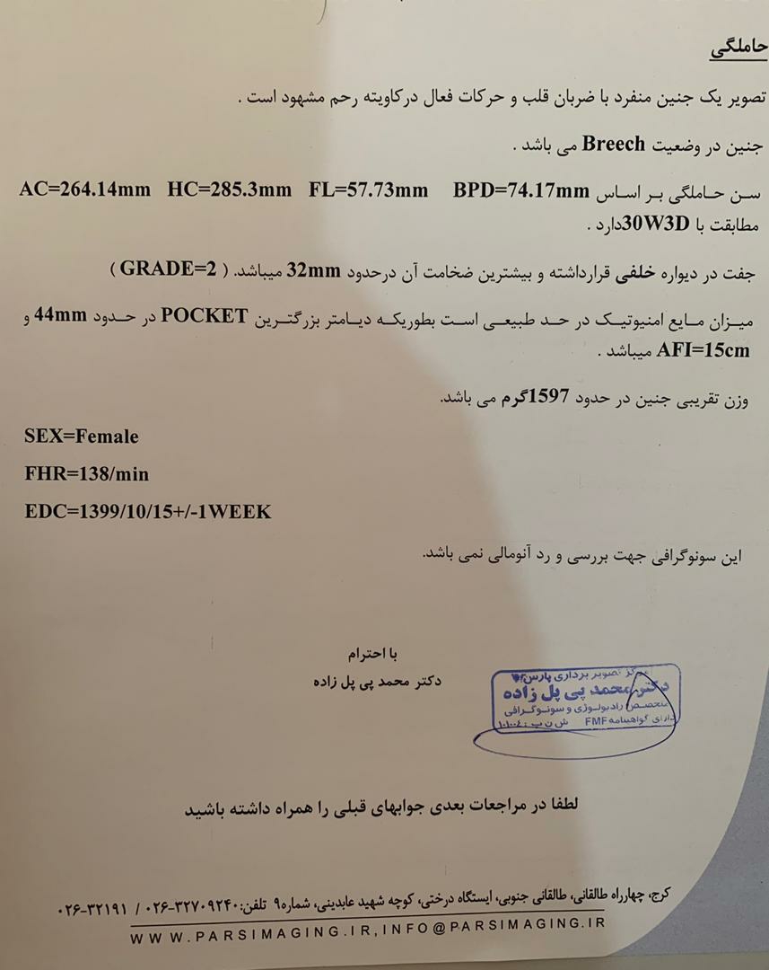 لطفاً سنو منو برسی کنید