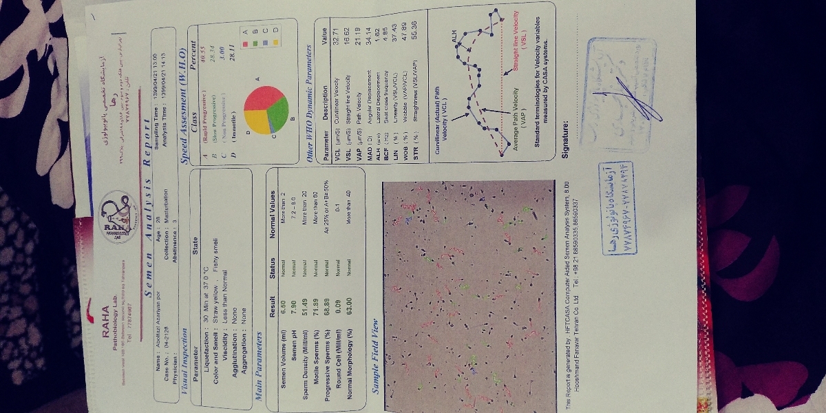 تفسیر آزمایش اسپرم همسرم تفسیر آزمایش اسپرم همسرم