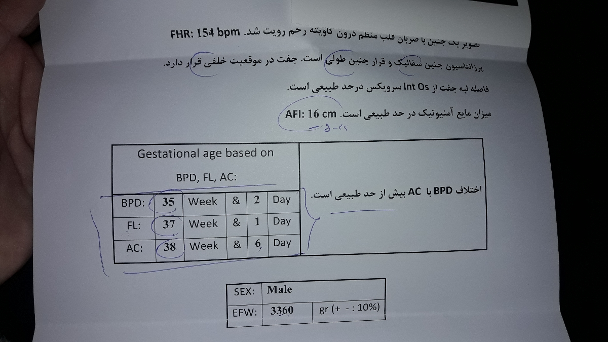 لطفا خیلی سریع جواب بدین فووووووریه لطفا خیلی سریع جواب بدین فووووووریه