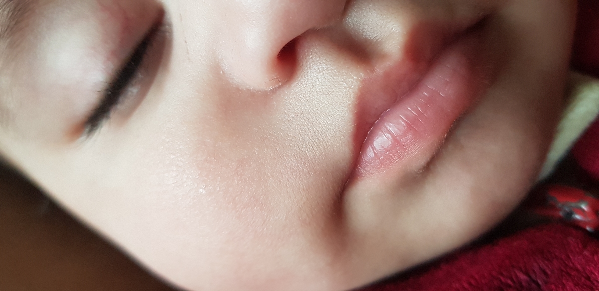 سلام موی بدن دخترم تیکه تیکه داره در میاد میخام ببینم طبیعیه؟ سلام موی بدن دخترم تیکه تیکه داره در میاد میخام ببینم طبیعیه؟