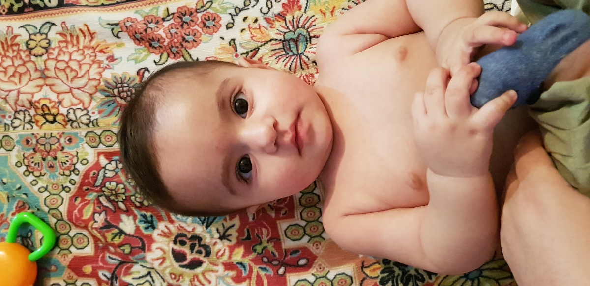 سلام موی بدن دخترم تیکه تیکه داره در میاد میخام ببینم طبیعیه؟ سلام موی بدن دخترم تیکه تیکه داره در میاد میخام ببینم طبیعیه؟