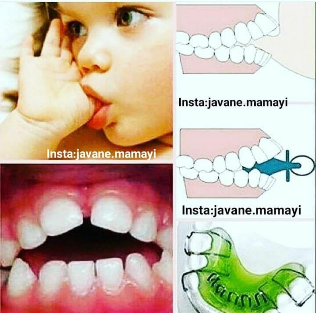 چنتا عکس میذارم برای سرگرمی😄 چنتا عکس میذارم برای سرگرمی😄