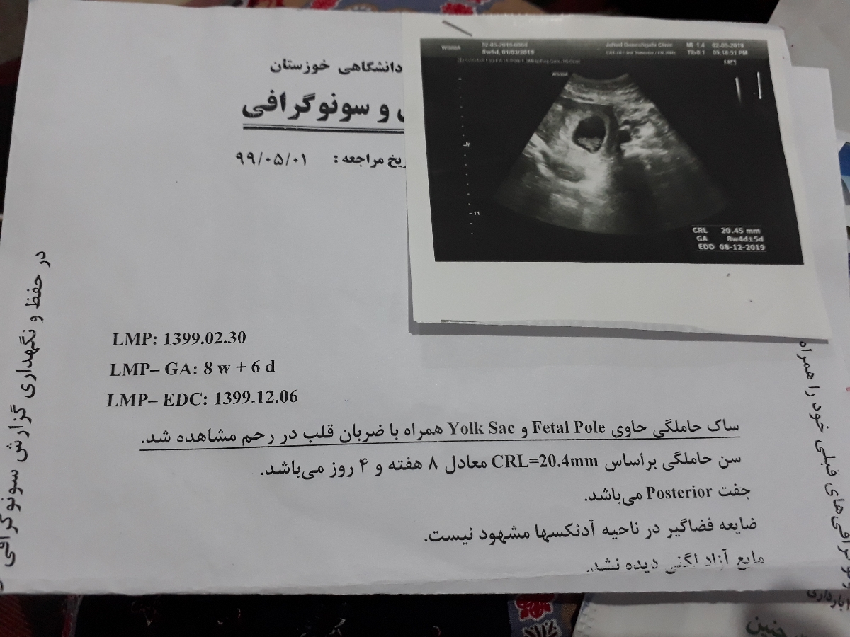 دیده نشدن جنین در هفته پنجم دیده نشدن جنین در هفته پنجم