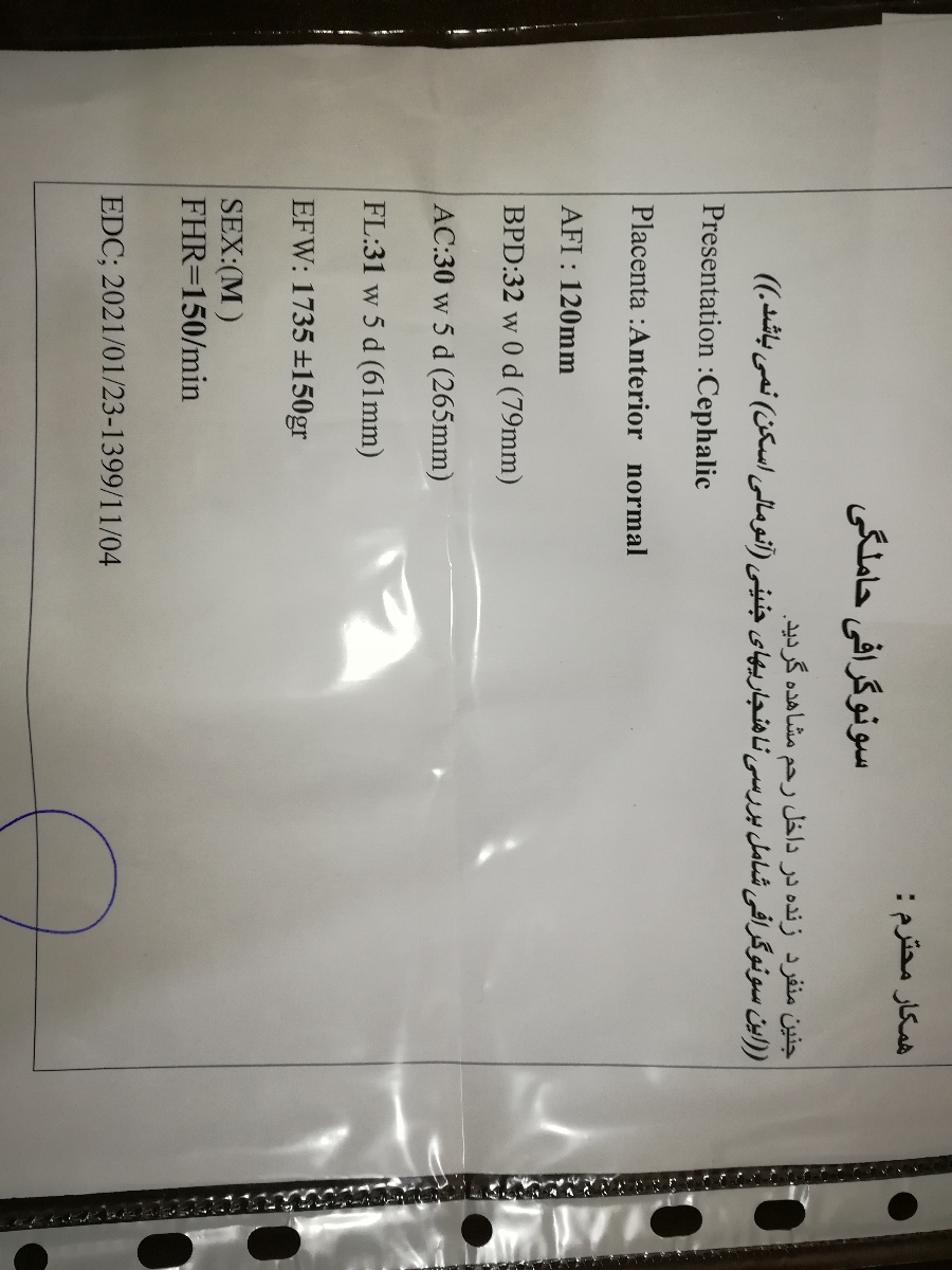 سلام بچه ها، بیاید سونوی وزن جنینو نگاه کنید بگید خوبه یا ن. ی سوال دیگه ام دارم سلام بچه ها، بیاید سونوی وزن جنینو نگاه کنید بگید خوبه یا ن. ی سوال دیگه ام دارم